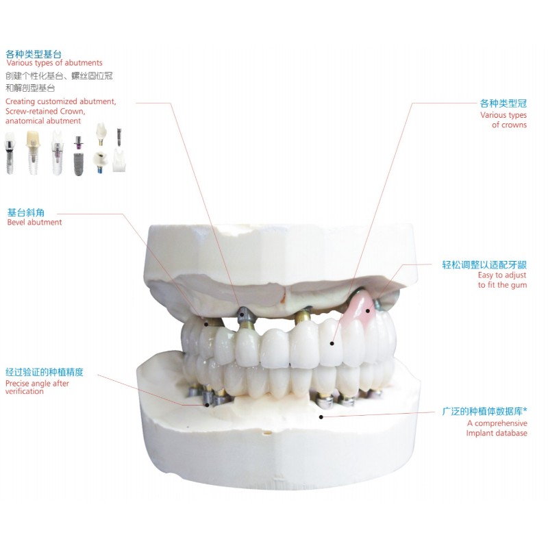 implante dentário