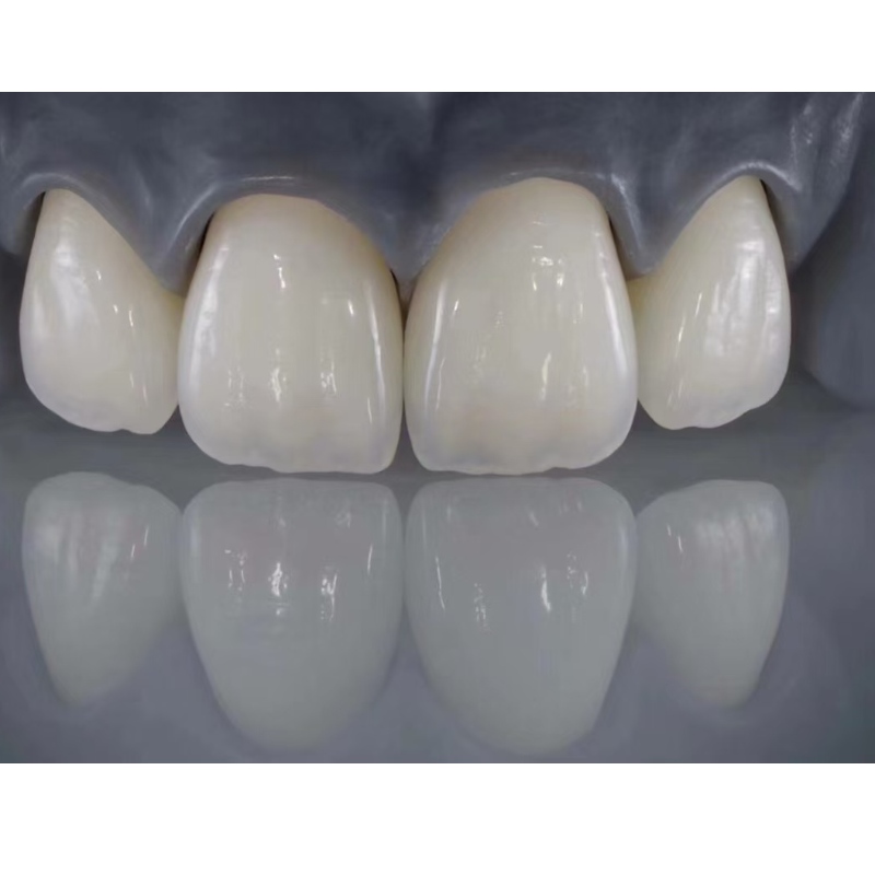 Todos-dentes de cerâmica